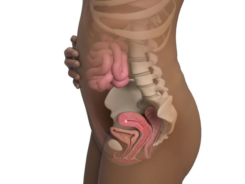 Image of a woman and her baby at 5 weeks of pregnancy.