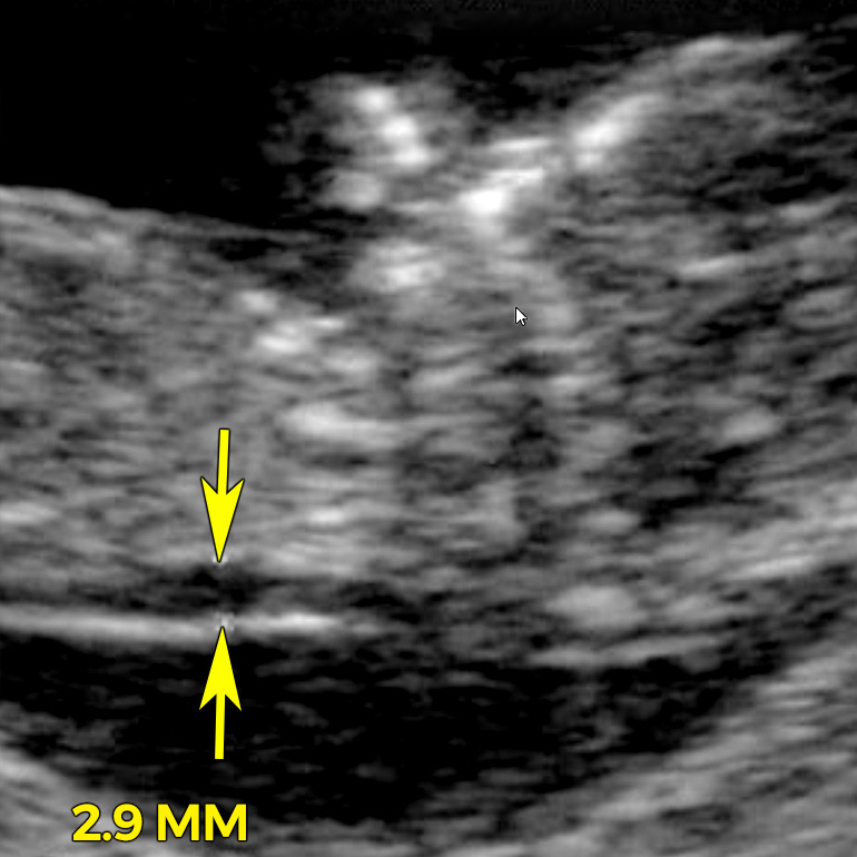 ultrasound image