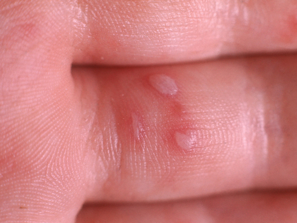 Biophoto Associates / Science Source