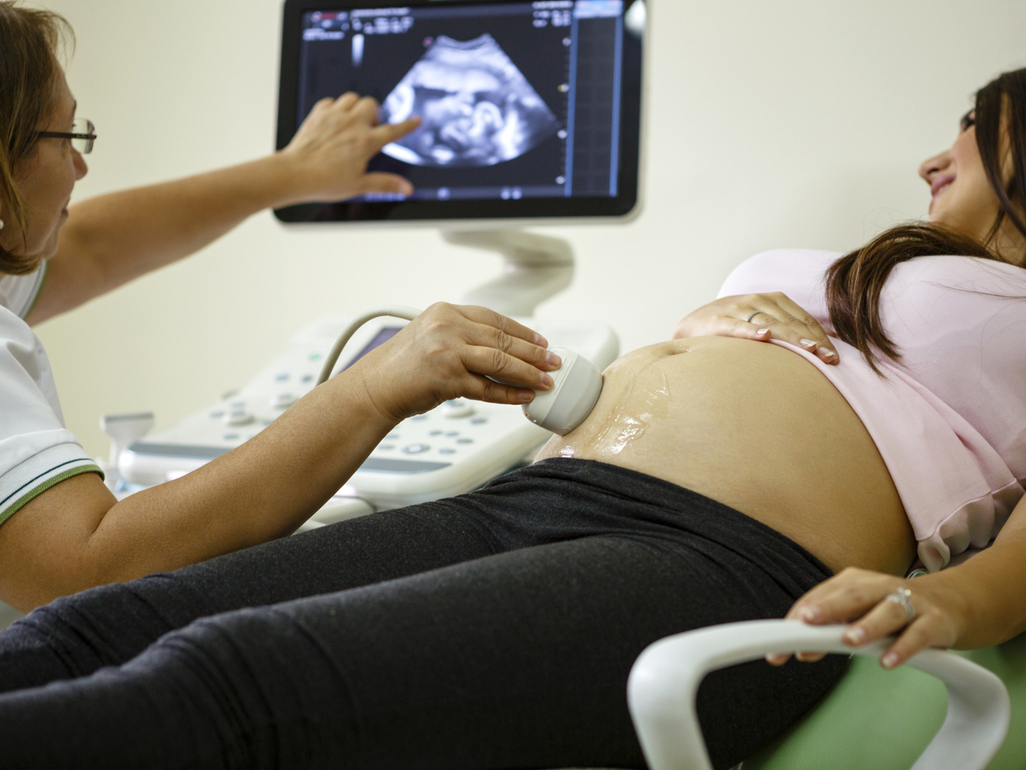 Woman having pregnancy scan