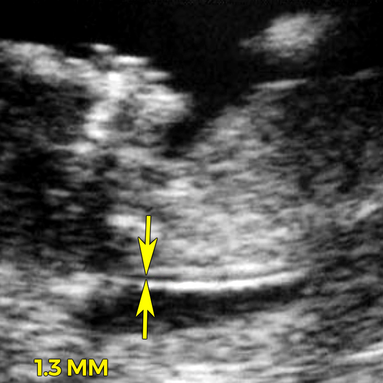 ultrasound image