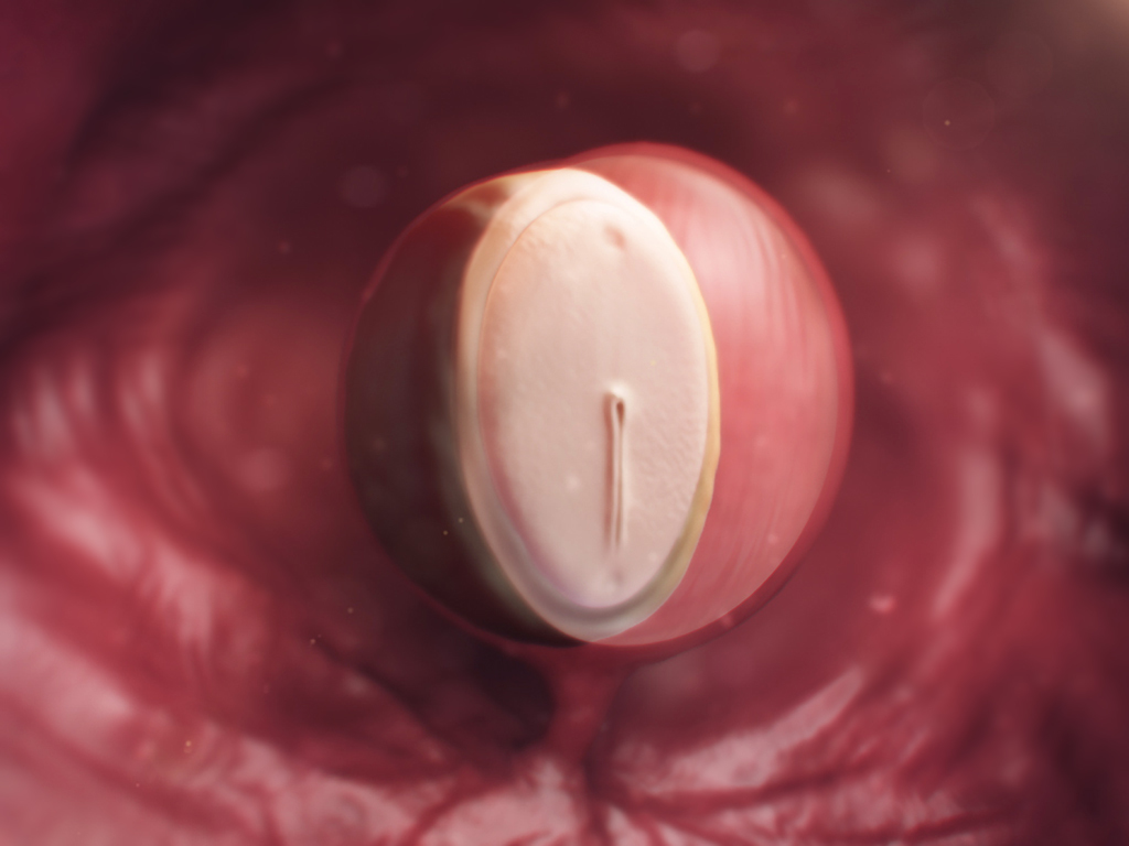 Computer-generated image of fertilised egg at week 4 with yolk sac and amniotic sac