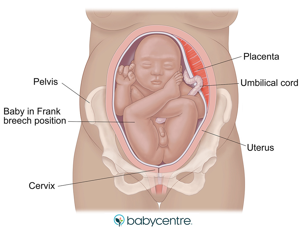 Baby in frank breech position