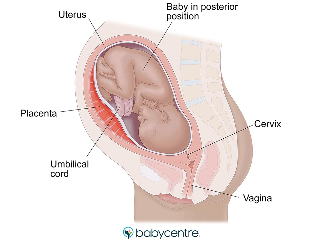 Baby in posterior position