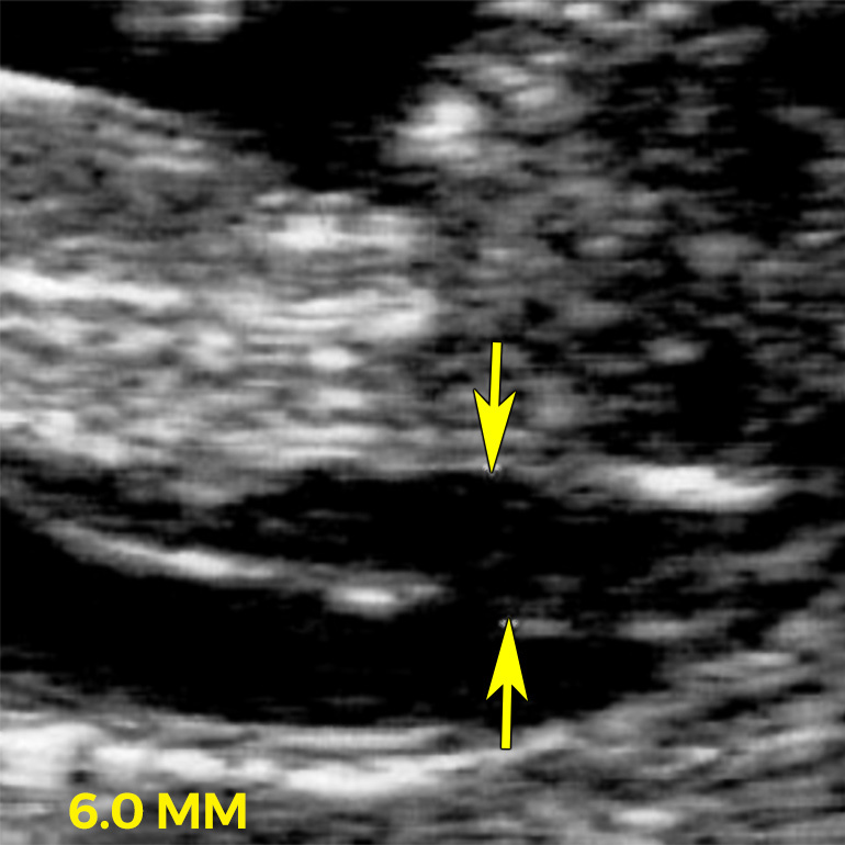 ultrasound image